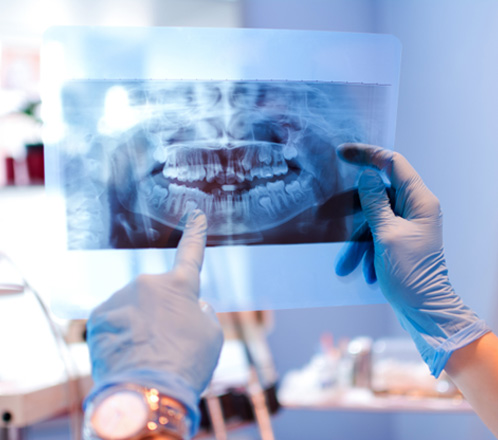 Dental with blue gloves looking at X-ray